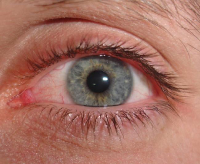 Blue Eye... ¡BLUE NOT GREEN!