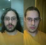 Foto anterior